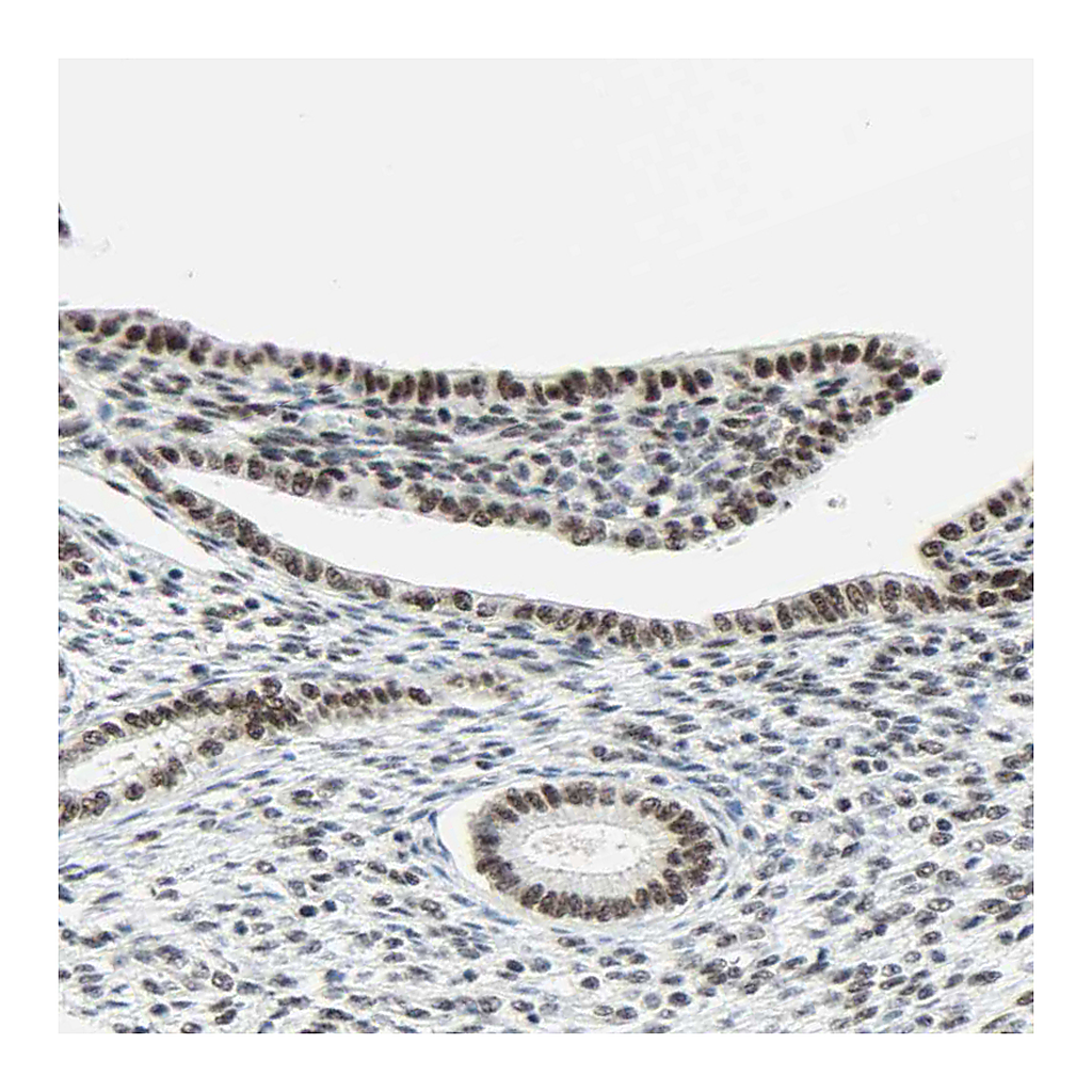Atlas Antibodies Anti-WTAP Antibody