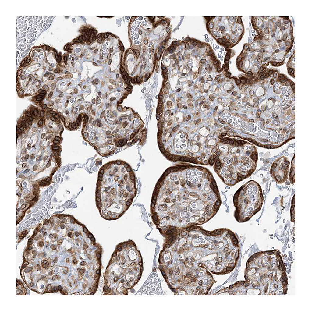 Atlas Antibodies Anti-WWP1 Antibody