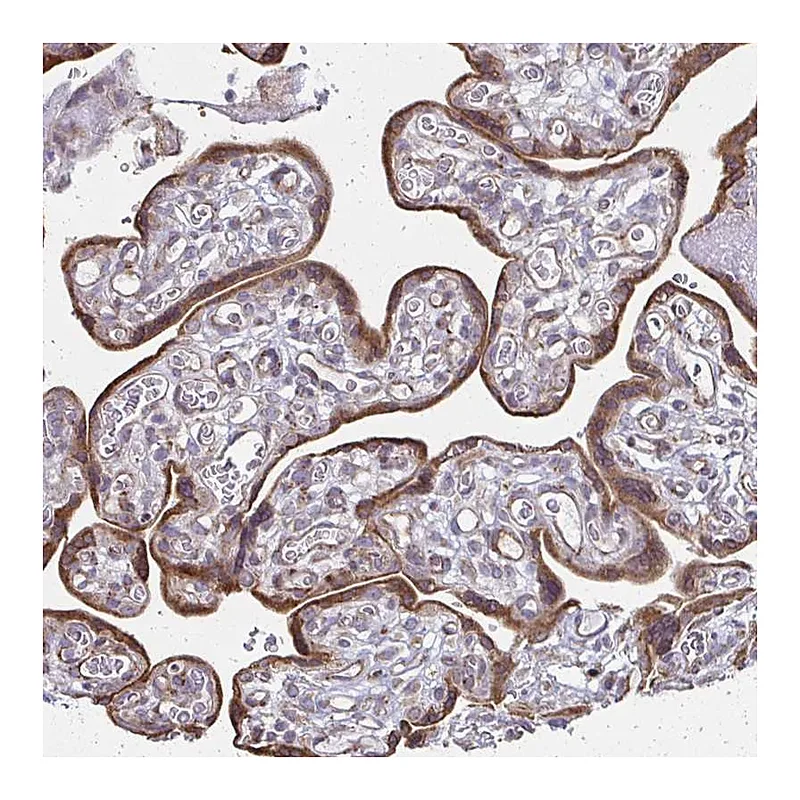 Atlas Antibodies Anti-XAGE2 Antibody