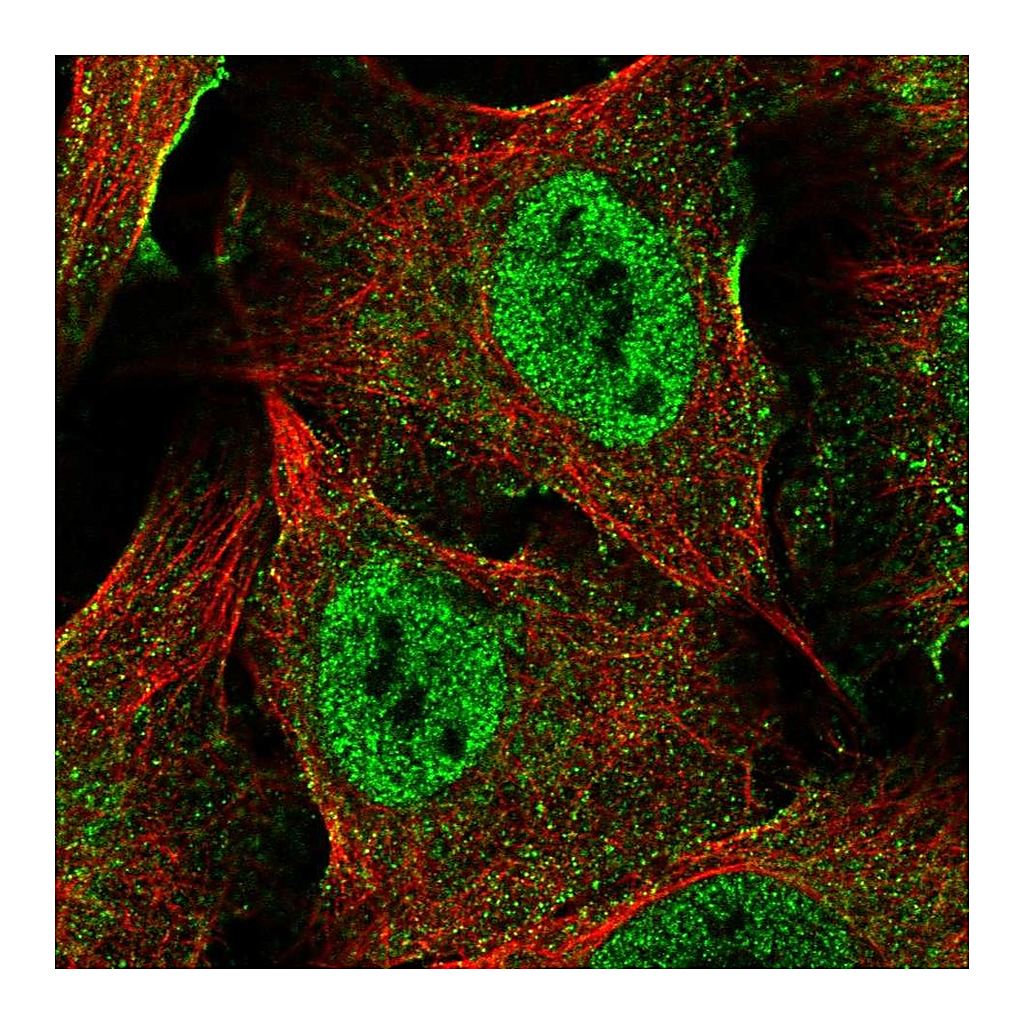 Atlas Antibodies Anti-XAGE5 Antibody
