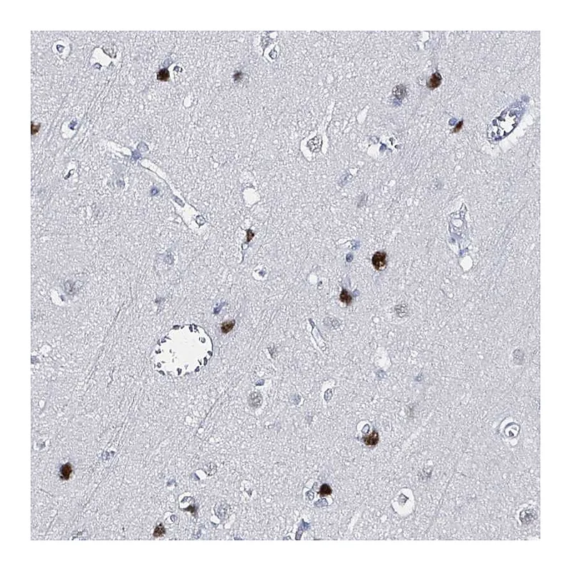 Atlas Antibodies Anti-XAGE3 Antibody