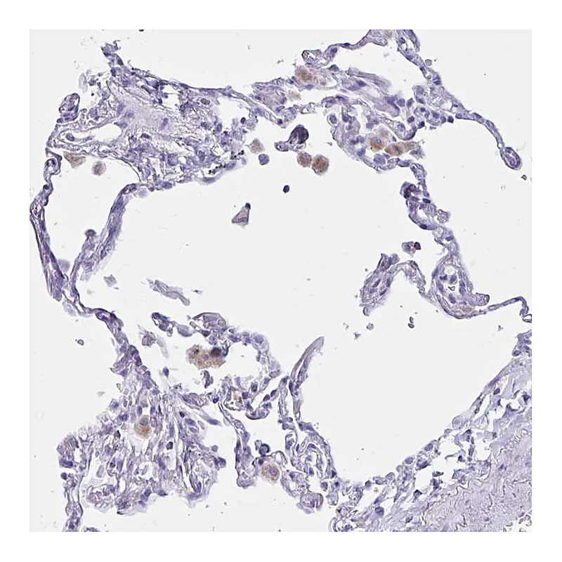 Atlas Antibodies Anti-XCL1 Antibody