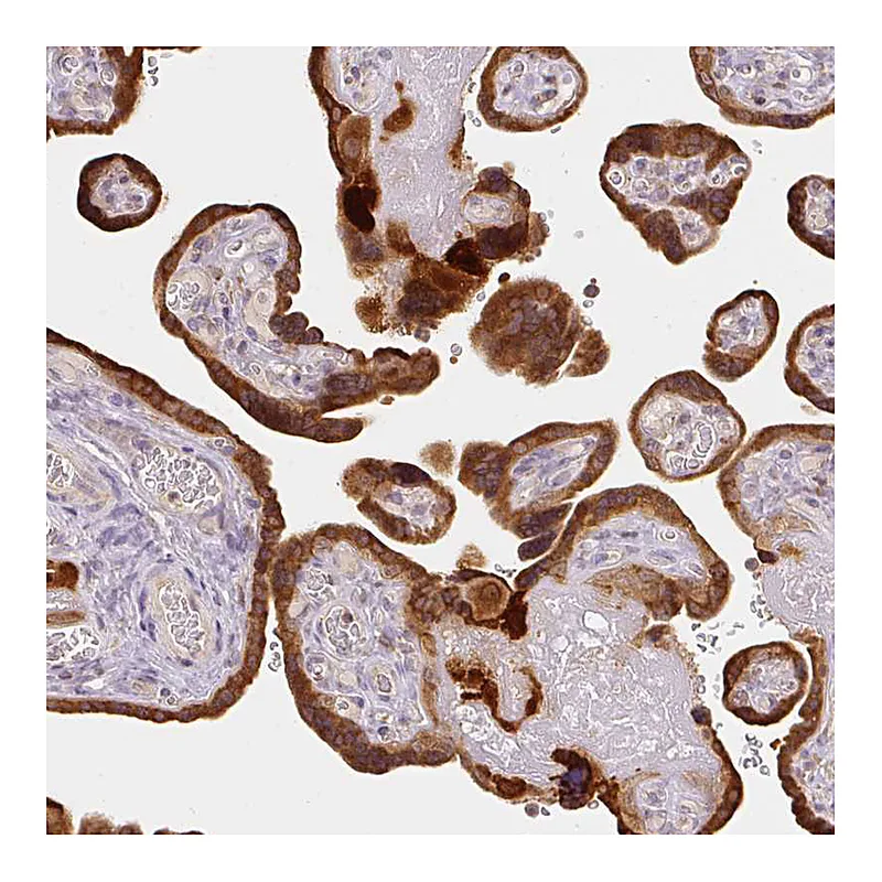Atlas Antibodies Anti-XAGE2 Antibody