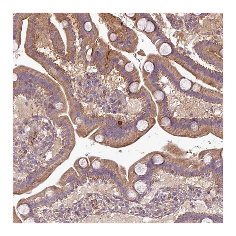 Atlas Antibodies Anti-XIAP Antibody