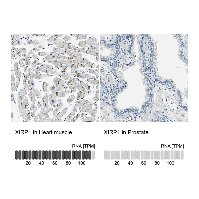 Atlas Antibodies Anti-XIRP1 Antibody