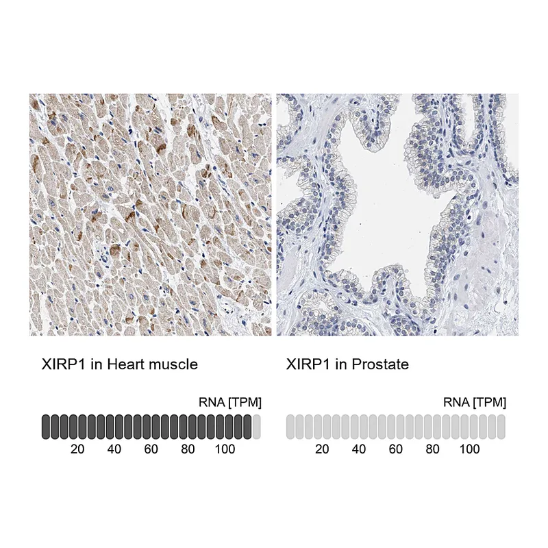 Atlas Antibodies Anti-XIRP1 Antibody