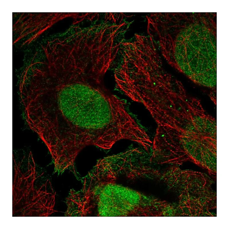 Atlas Antibodies Anti-XPC Antibody