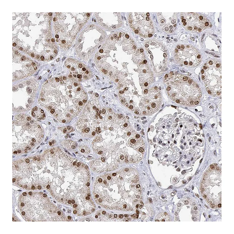 Atlas Antibodies Anti-XPC Antibody