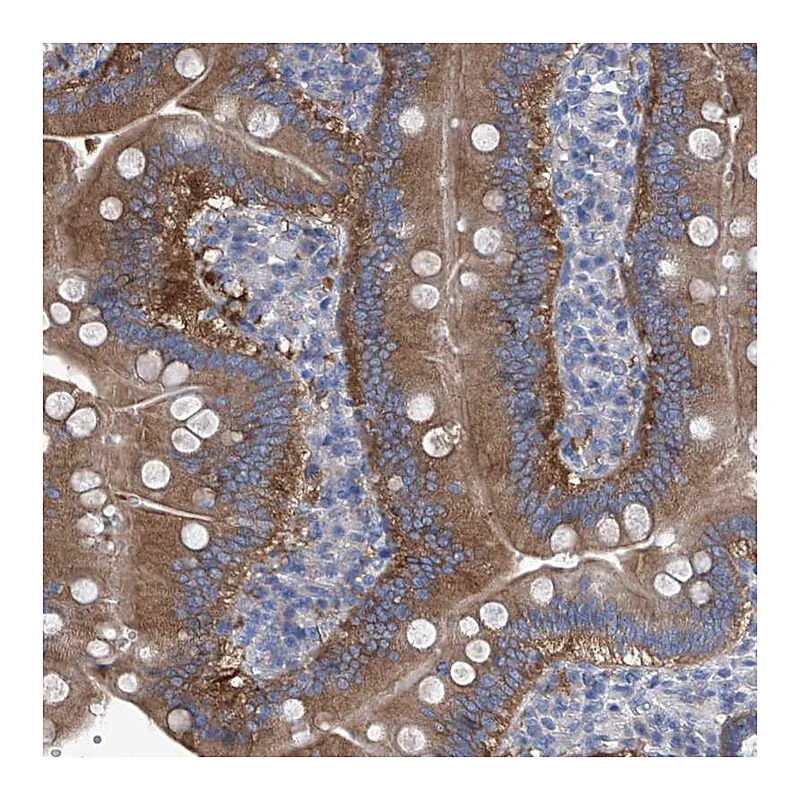 Atlas Antibodies Anti-XPNPEP1 Antibody