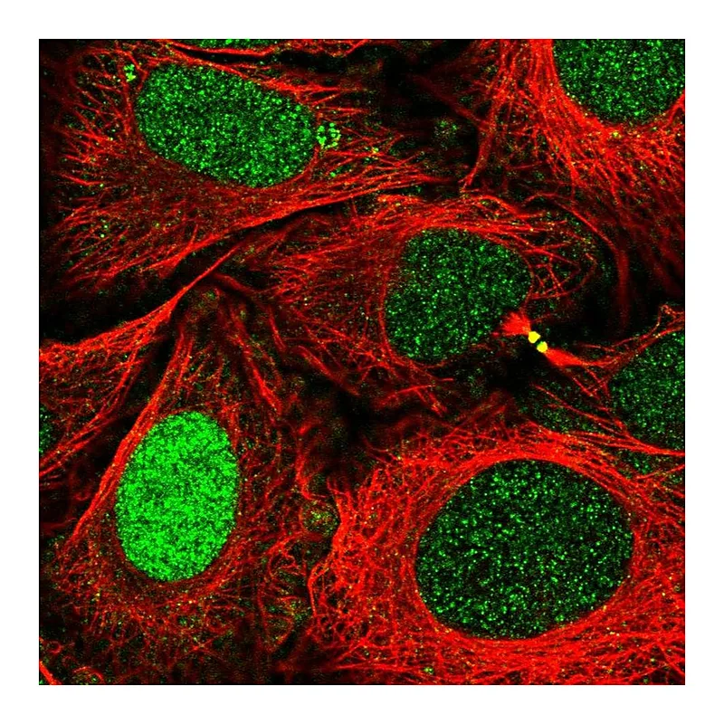 Atlas Antibodies Anti-XPA Antibody