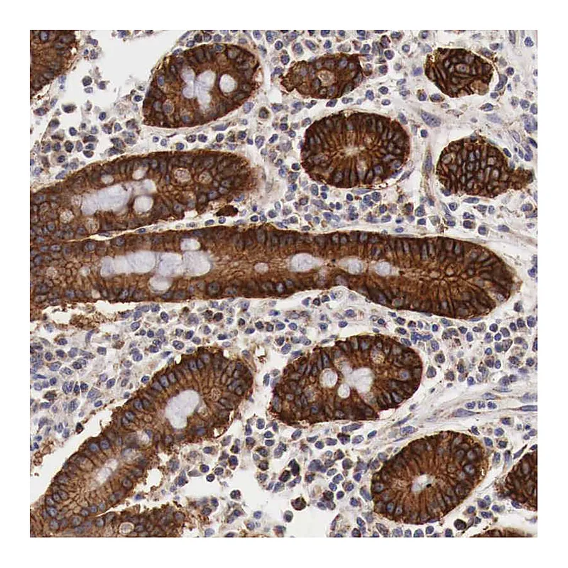 Atlas Antibodies Anti-XPNPEP3 Antibody