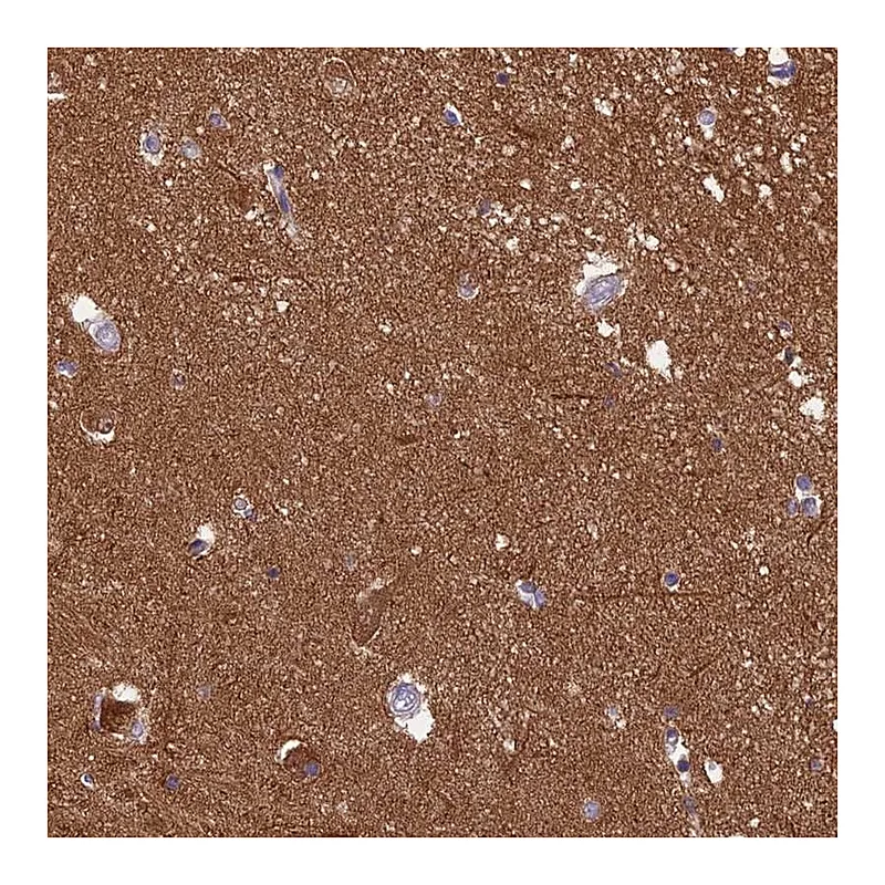 Atlas Antibodies Anti-XPO7 Antibody