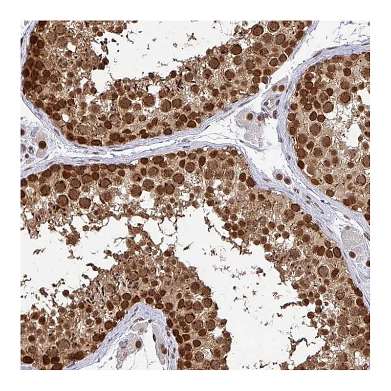 Atlas Antibodies Anti-XPO1 Antibody