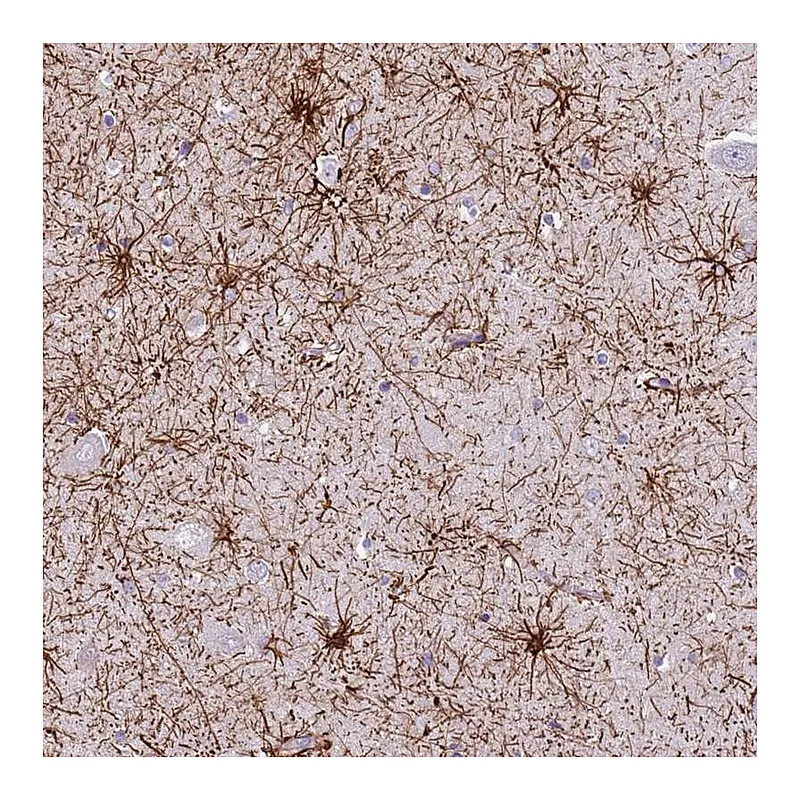 Atlas Antibodies Anti-XPO7 Antibody
