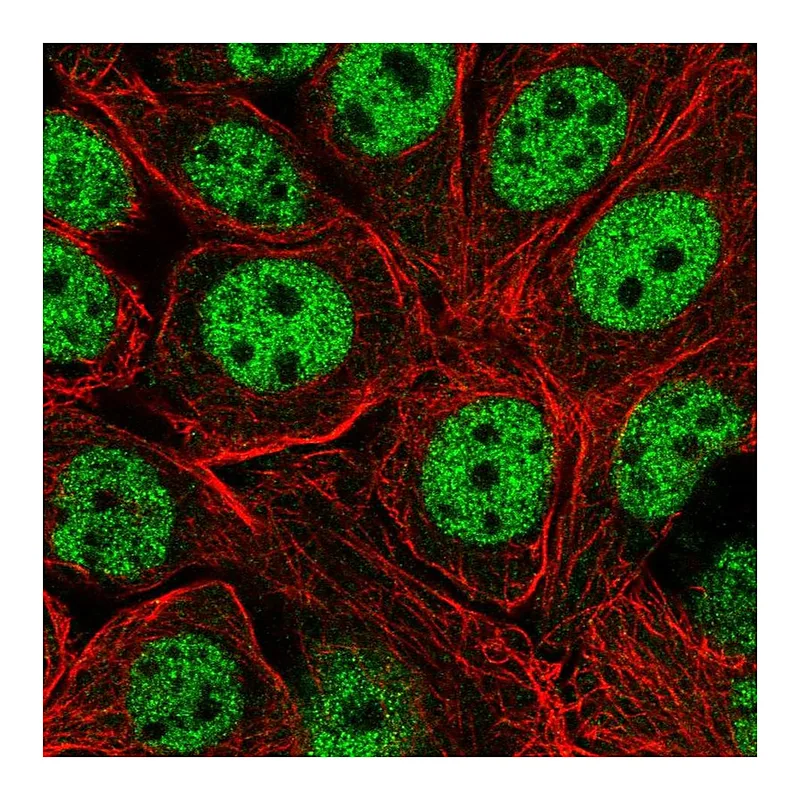 Atlas Antibodies Anti-XPOT Antibody