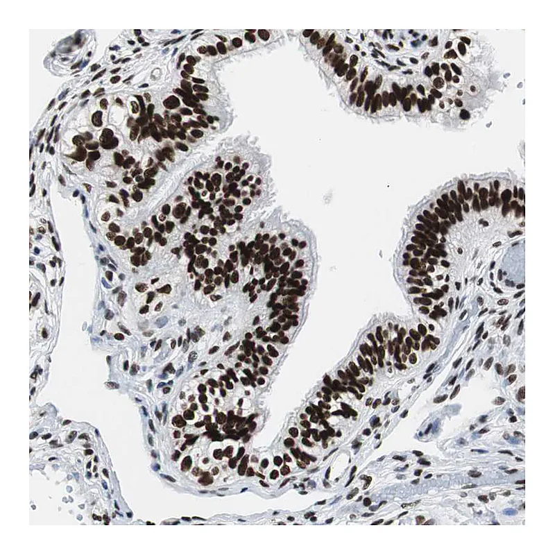Atlas Antibodies Anti-XRCC1 Antibody