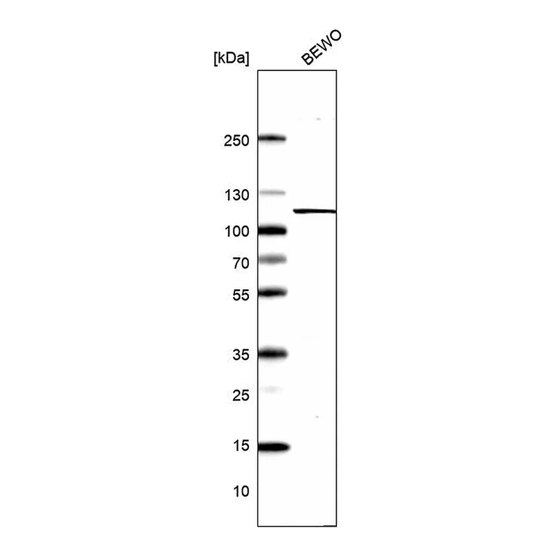 Atlas Antibodies Anti-XPOT Antibody