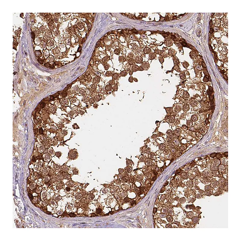 Atlas Antibodies Anti-XPR1 Antibody