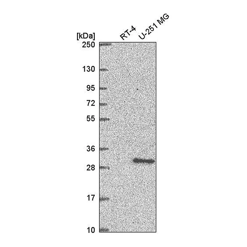 Atlas Antibodies Anti-XRCC3 Antibody