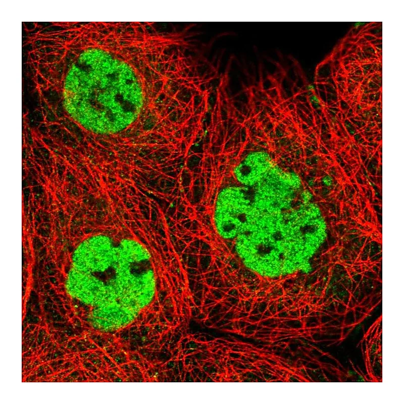 Atlas Antibodies Anti-XRCC4 Antibody