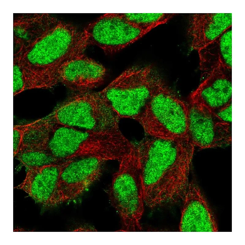 Atlas Antibodies Anti-XRCC5 Antibody