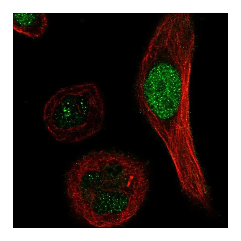Atlas Antibodies Anti-XRCC3 Antibody