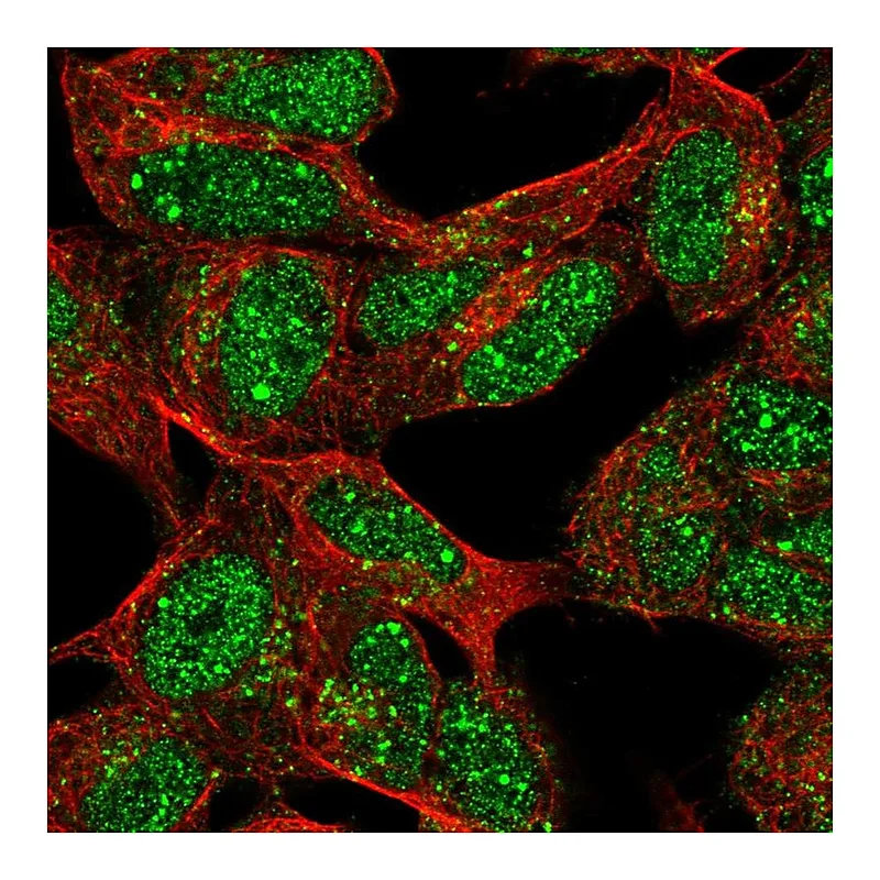 Atlas Antibodies Anti-XRCC2 Antibody
