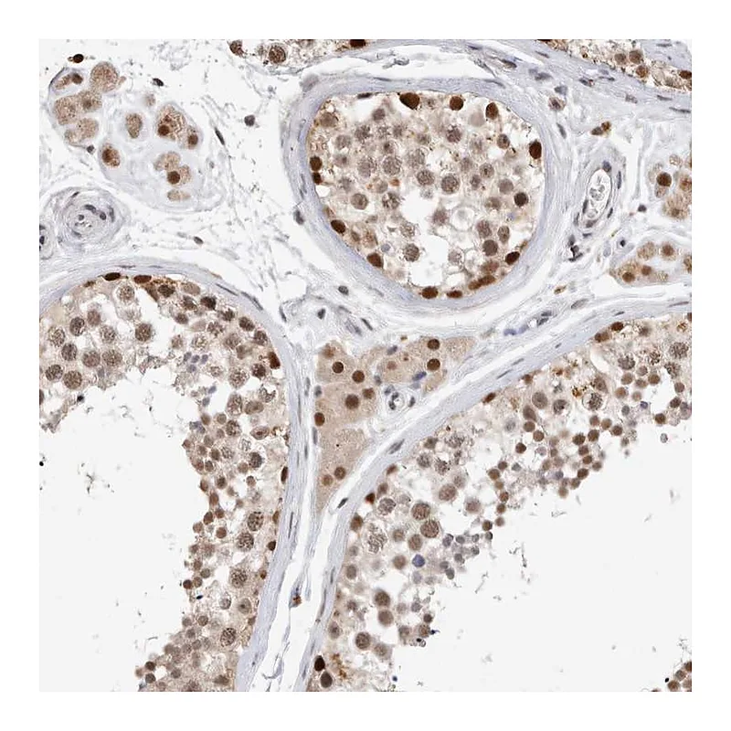 Atlas Antibodies Anti-XRCC5 Antibody