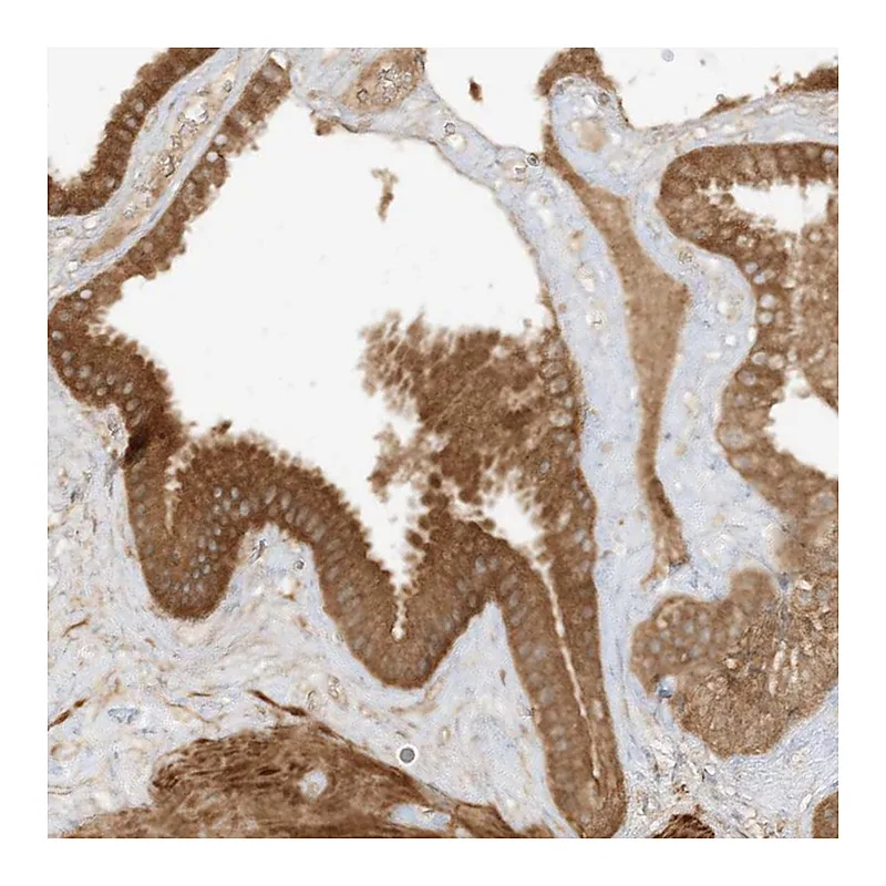 Atlas Antibodies Anti-XRN1 Antibody