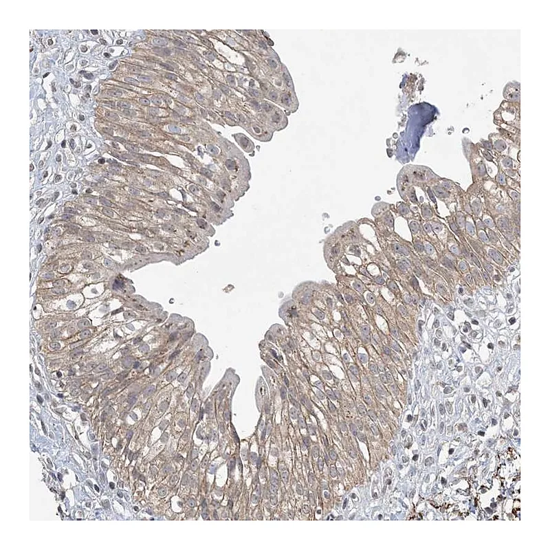 Atlas Antibodies Anti-XRN1 Antibody