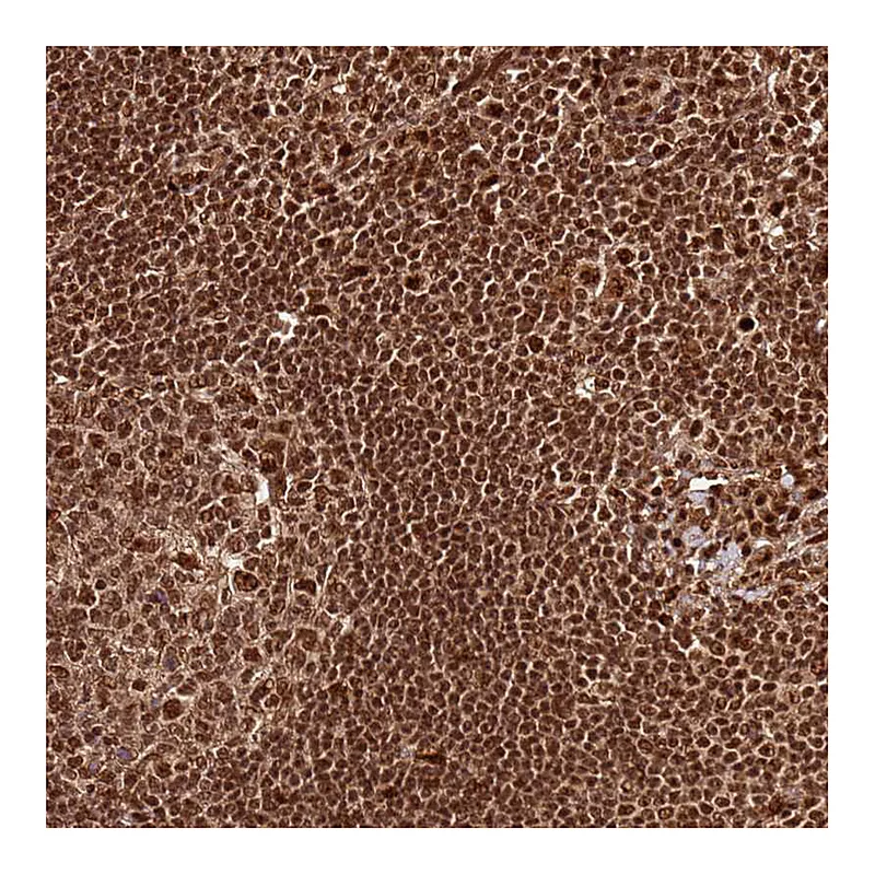 Atlas Antibodies Anti-XRN2 Antibody