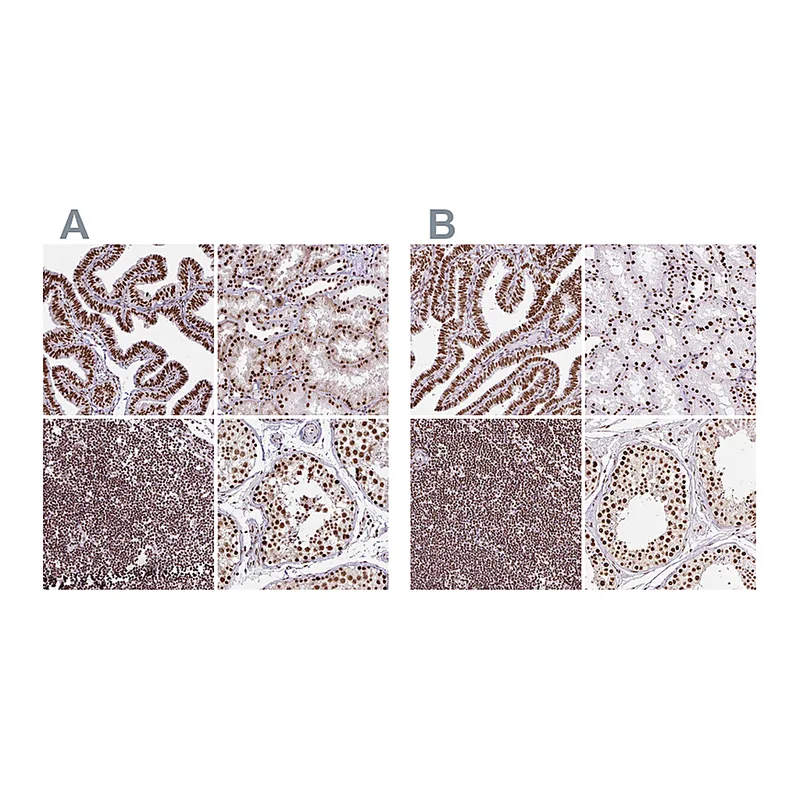 Atlas Antibodies Anti-XRCC6 Antibody