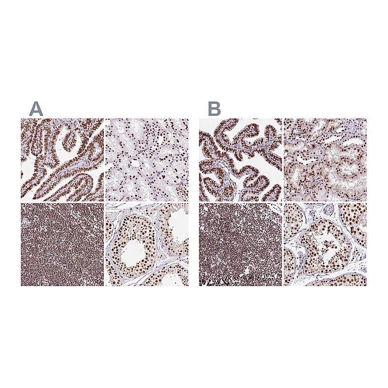 Atlas Antibodies Anti-XRCC6 Antibody