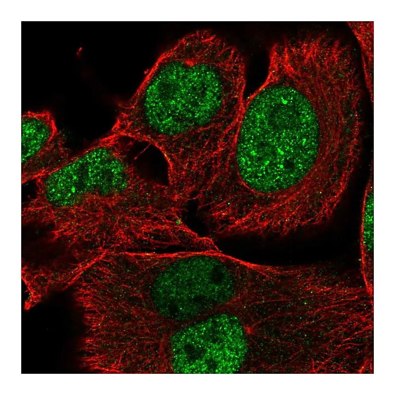 Atlas Antibodies Anti-XRRA1 Antibody