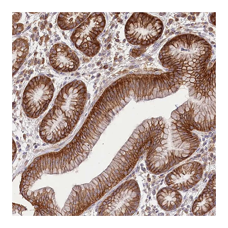 Atlas Antibodies Anti-XYLB Antibody