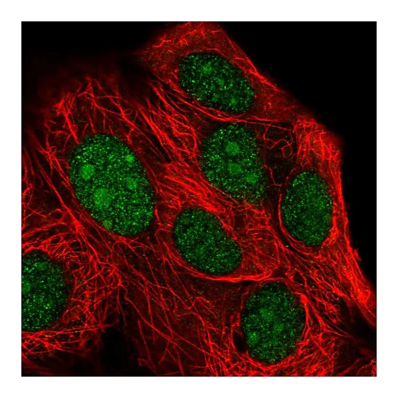 Atlas Antibodies Anti-XRN2 Antibody