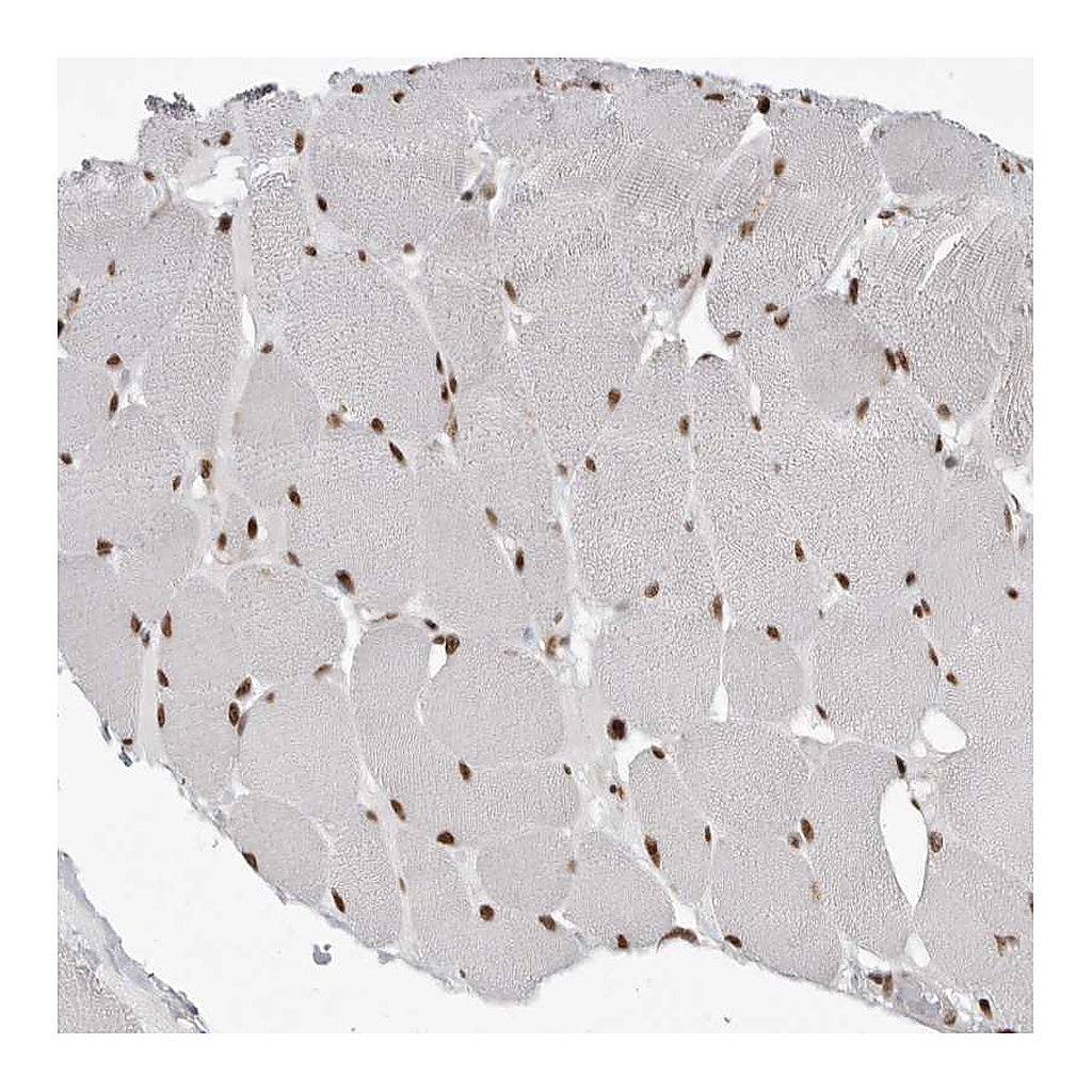 Atlas Antibodies Anti-YAF2 Antibody