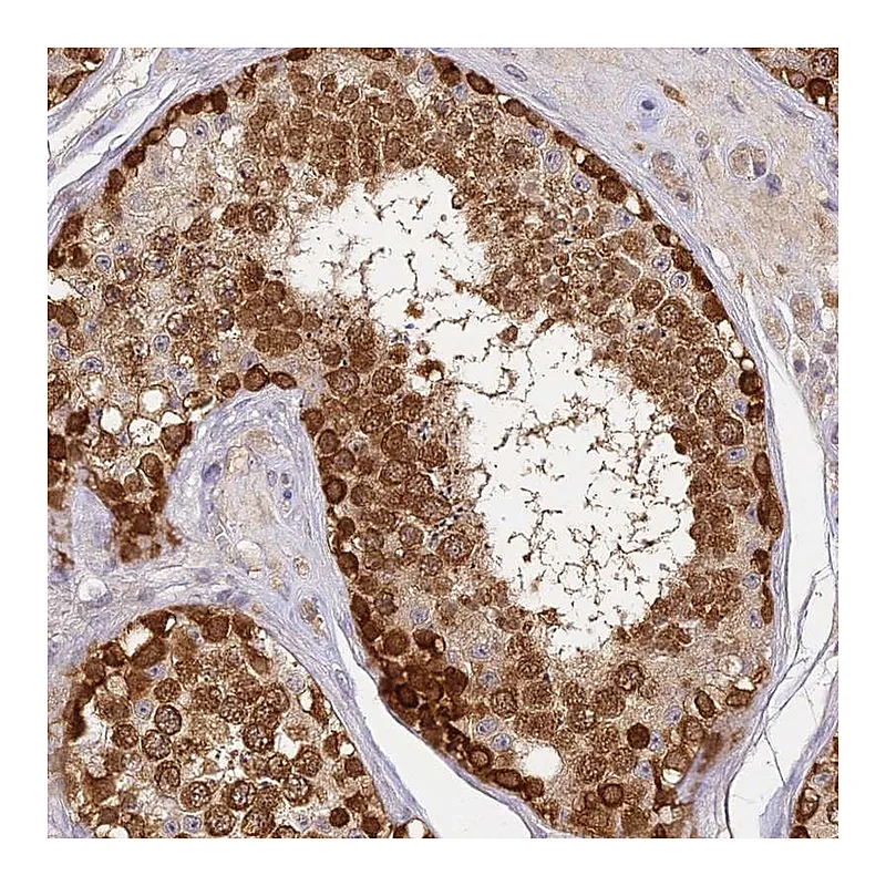 Atlas Antibodies Anti-YAE1D1 Antibody