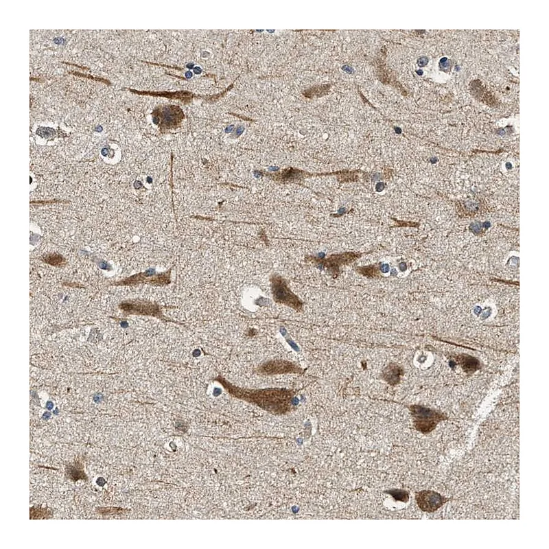 Atlas Antibodies Anti-YAE1D1 Antibody