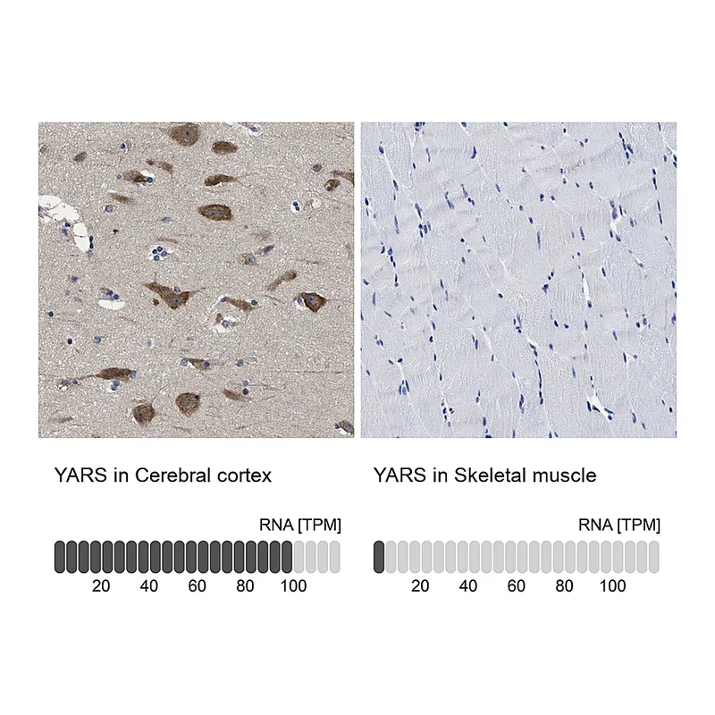 Atlas Antibodies Anti-YARS Antibody