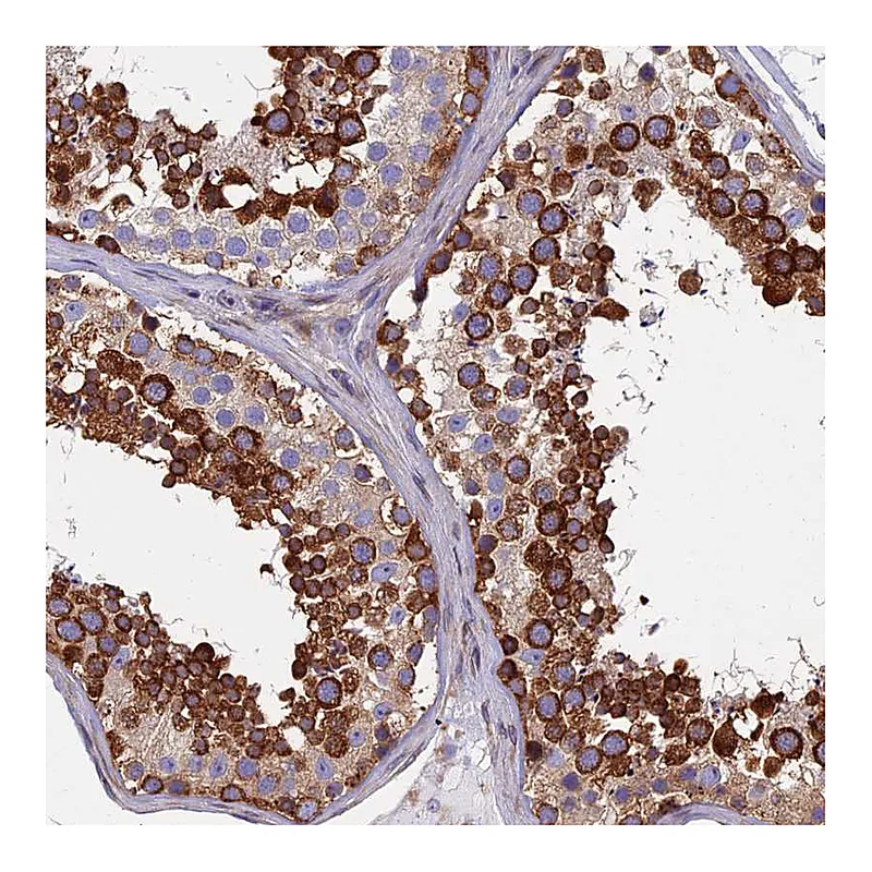 Atlas Antibodies Anti-YBX1 Antibody