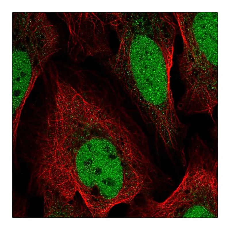 Atlas Antibodies Anti-YEATS4 Antibody