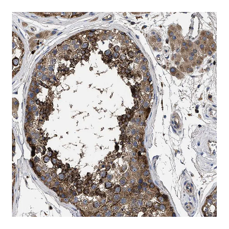 Atlas Antibodies Anti-YBEY Antibody