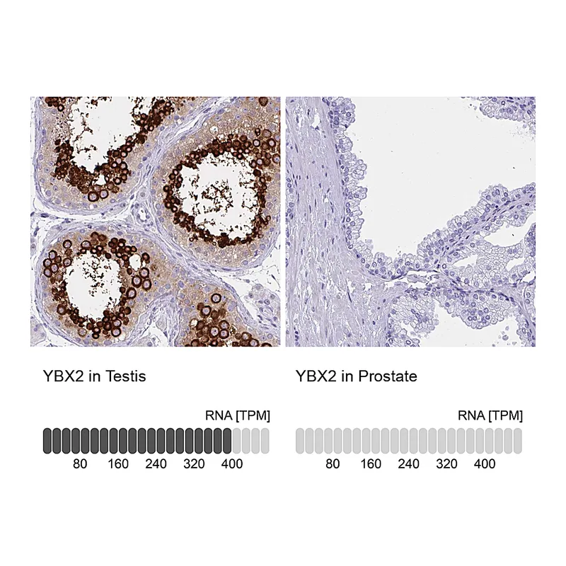 Atlas Antibodies Anti-YBX2 Antibody