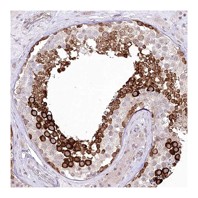 Atlas Antibodies Anti-YBX3 Antibody