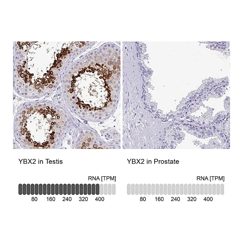 Atlas Antibodies Anti-YBX2 Antibody