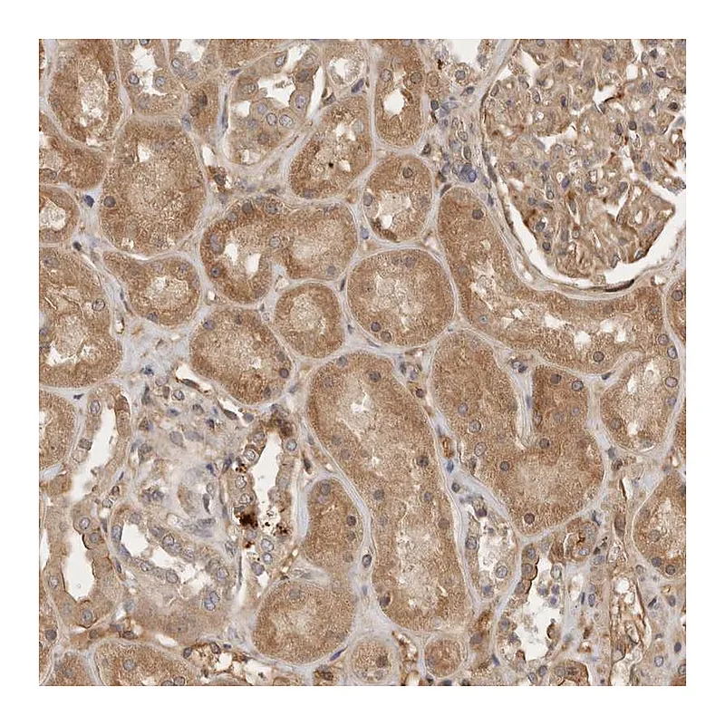 Atlas Antibodies Anti-YES1 Antibody