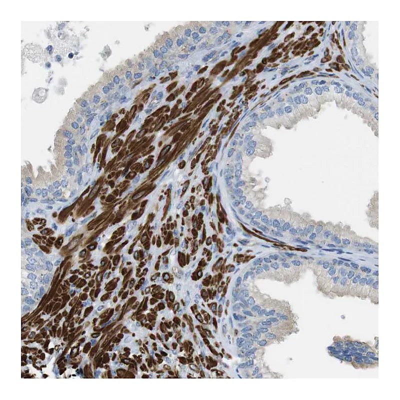 Atlas Antibodies Anti-YIF1A Antibody