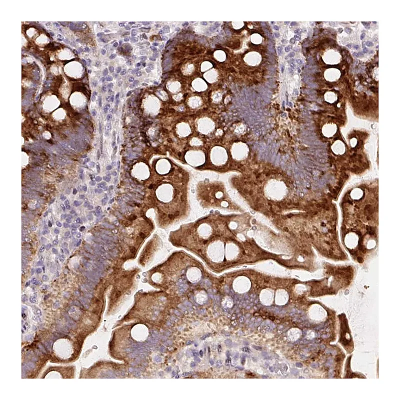 Atlas Antibodies Anti-YIF1B Antibody