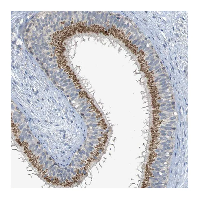 Atlas Antibodies Anti-YIPF3 Antibody